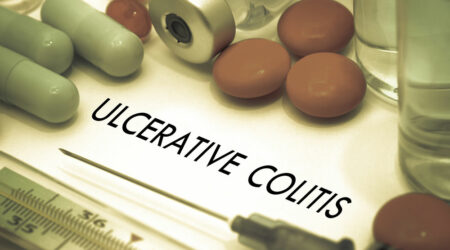 Ulcerative colitis – Symptoms, causes, and treatment