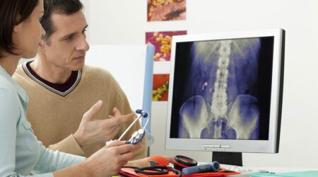 Causes, symptoms, and management for kidney stones