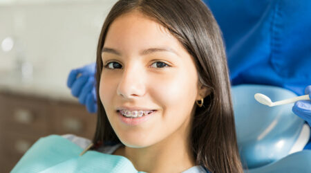 4 common types of dental braces