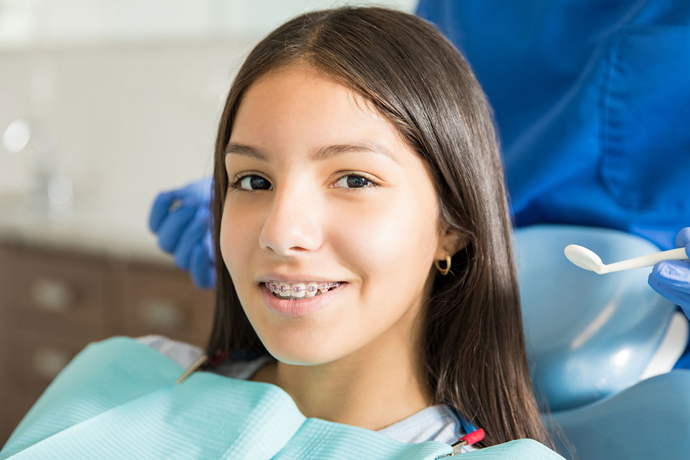 4 common types of dental braces